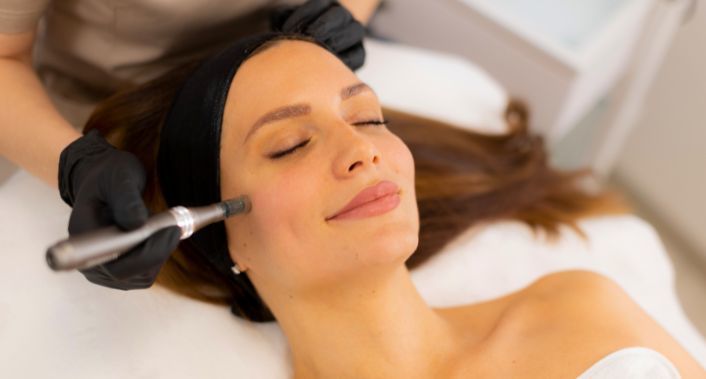 Dra. Joeline Corrêa, Clareamento Facial com Peeling de Cristal com Dra. Joeline Corrêa Dra. Joeline Corrêa, Clareamento Facial com Peeling de Cristal com Dra. Joeline Corrêa