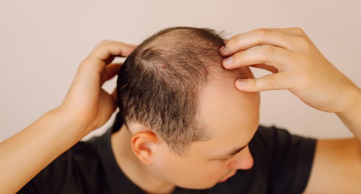 Aurister Lopes Biomedicina Estética, Tratamento saúde capilar: Avaliação + Exame de tricoscopia + 3 Alta frequência