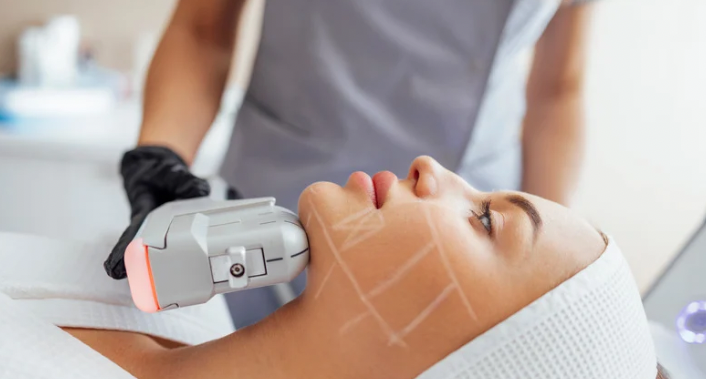 Dra. Kálita Beatriz Fisioterapia e Estética, Ultrassom Microfocado com Dra. Kálita Beatriz Fisioterapia e Estética