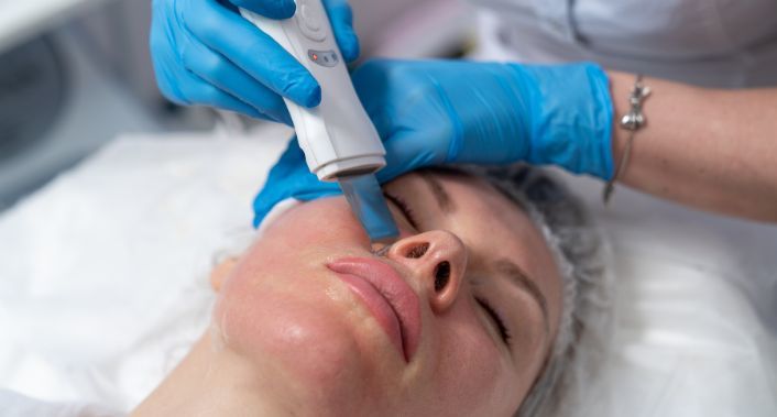 Vitta Lume Esthetic, Limpeza de Pele Completa: Peeling de Diamante + Extração + Tonificação