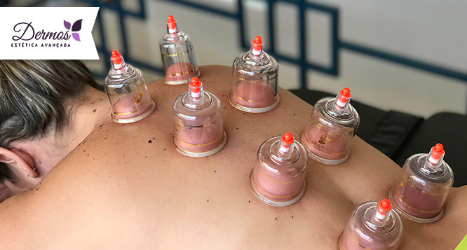 Massagem relaxante + Ventosaterapia + Liberação com pistola massageadora Massagem relaxante + Ventosaterapia + Liberação com pistola massageadora