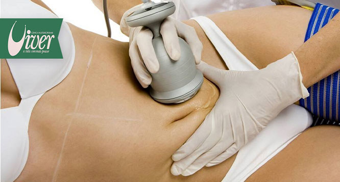 Pacote para redução de medidas com Lipocavitação na Clínica Viver São Cristóvão Pacote para redução de medidas com Lipocavitação na Clínica Viver São Cristóvão