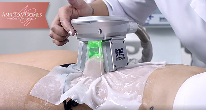 1 Avaliação + 02 Regiões de Criolipólise na Amanda Gomes Fisioterapia Estética 1 Avaliação + 02 Regiões de Criolipólise na Amanda Gomes Fisioterapia Estética
