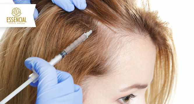 1 Aplicação de Enzimas para queda de cabelo + Alta Frequência + Ledterapia 1 Aplicação de Enzimas para queda de cabelo + Alta Frequência + Ledterapia