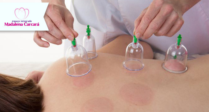 3 sessões de Ventosas + 3 sessões de Endermoterapia + 3 sessões de Manta térmica 3 sessões de Ventosas + 3 sessões de Endermoterapia + 3 sessões de Manta térmica