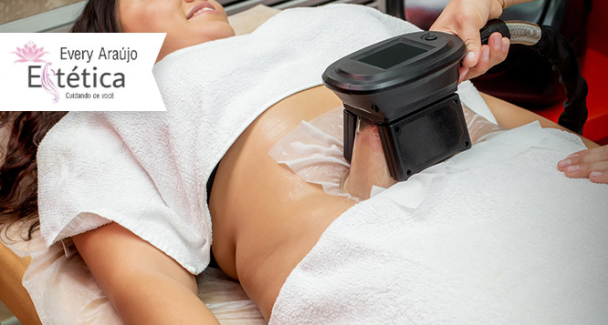 2 Áreas de Criolipolise + 1 Rádio+ 2 Redutora de Pimenta+ 2 Lipo gessada 2 Áreas de Criolipolise + 1 Rádio+ 2 Redutora de Pimenta+ 2 Lipo gessada