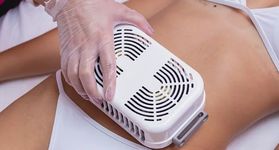 Belíssima Centro de Estética, 2 áreas de Criolipólise (abdome inferior/superior OU abdome inferior e flancos) Belíssima Centro de Estética, 2 áreas de Criolipólise (abdome inferior/superior OU abdome inferior e flancos)